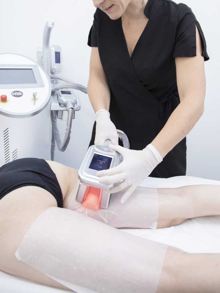 cryolipolise HTA Technologie cryo minceur cellulite